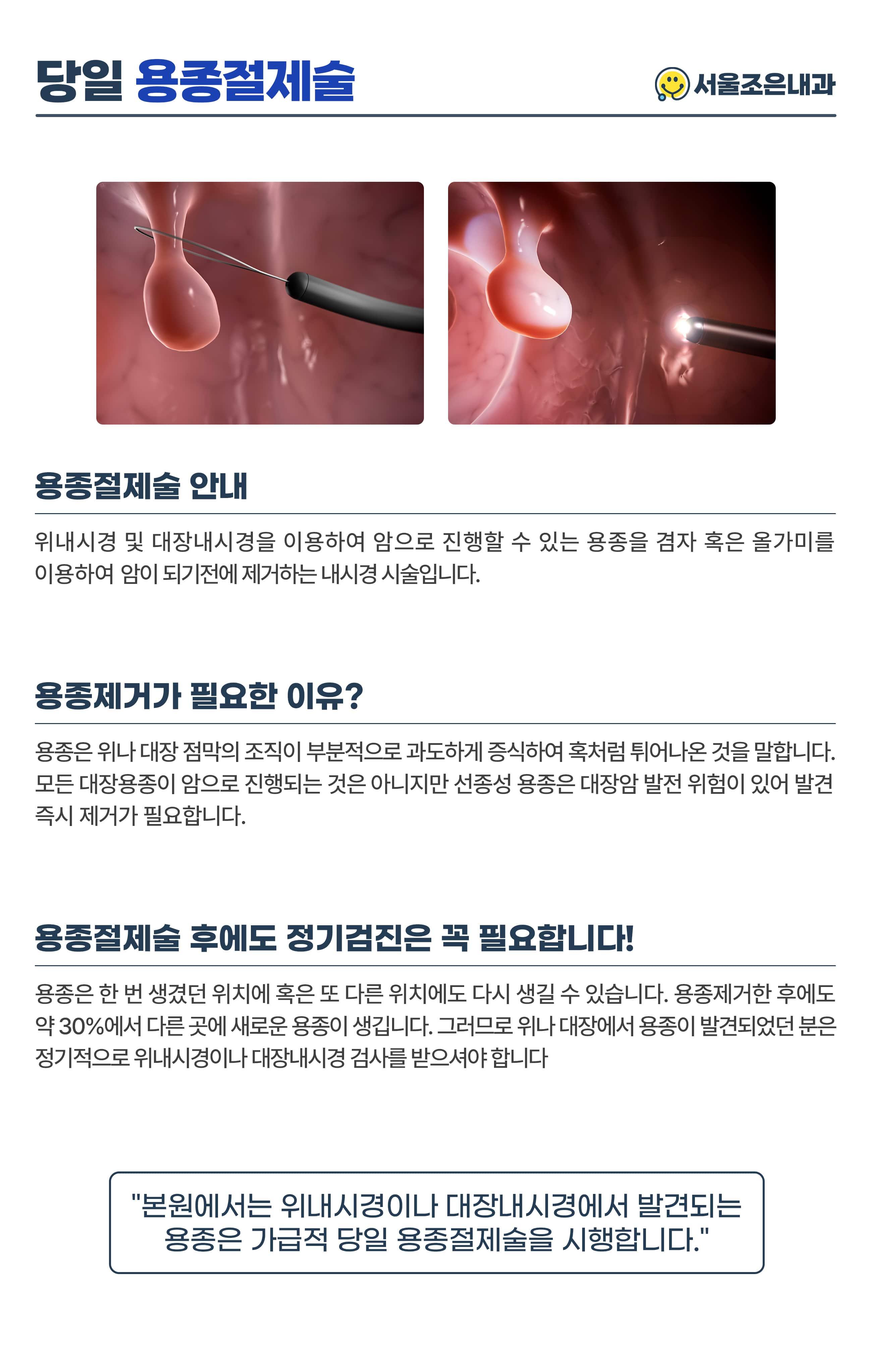 당일 용종절제술